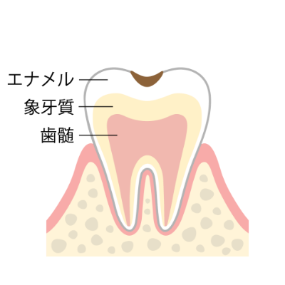 C1