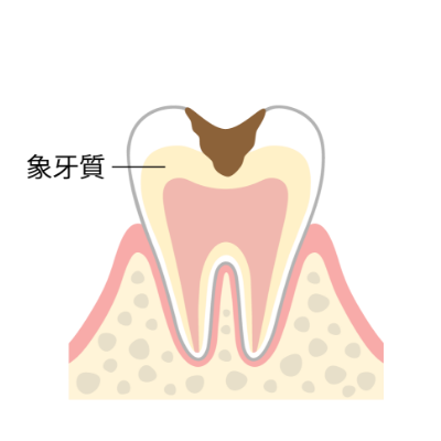 C2