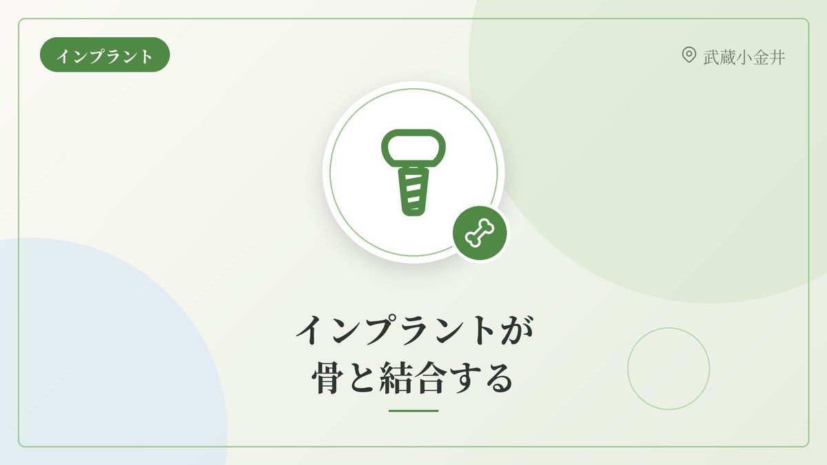 口腔インプラント学会ガイドラインで読み解くインプラント治療【第2回